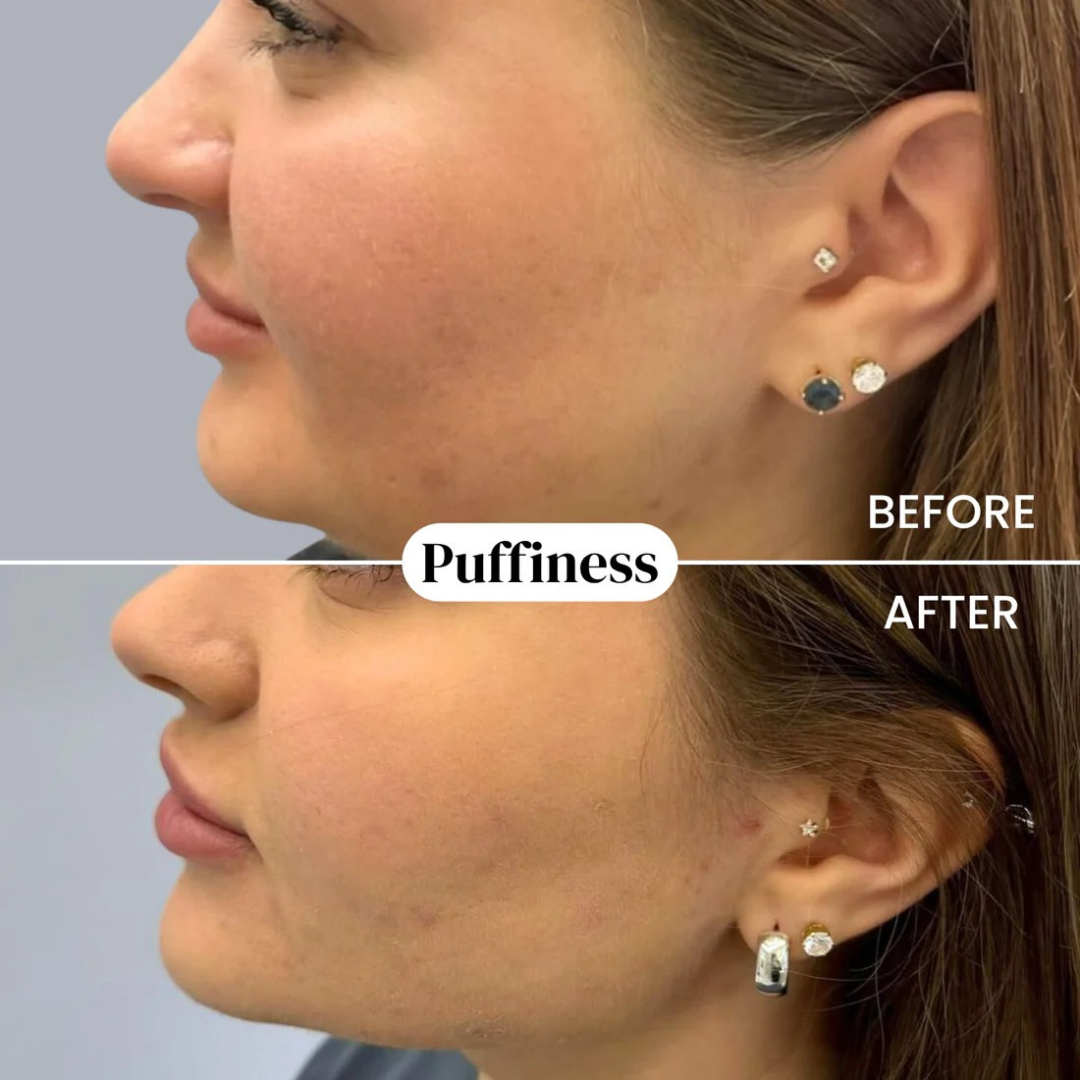 Organic Lymphatic Drainage Drops